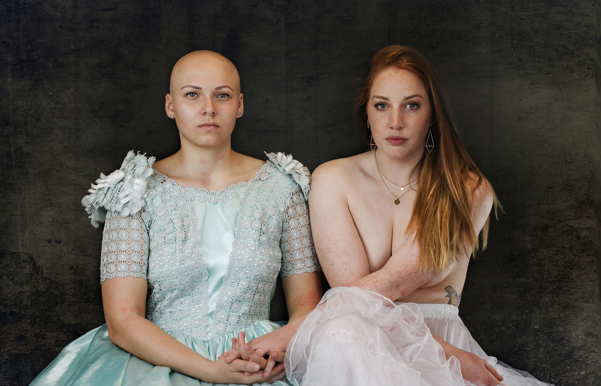 Liefde in tijden van Alopecia